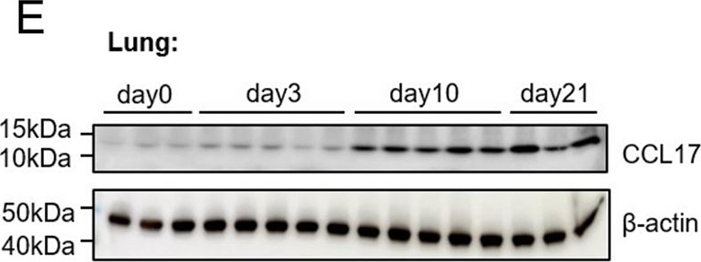 Fig.6.E showing Western Blotting in a Homo sapiens (Human) sample from the publication: Serum C-C motif chemokine ligand 17 as a predictive biomarker for the progression of non-idiopathic pulmonary fibrosis interstitial lung disease.