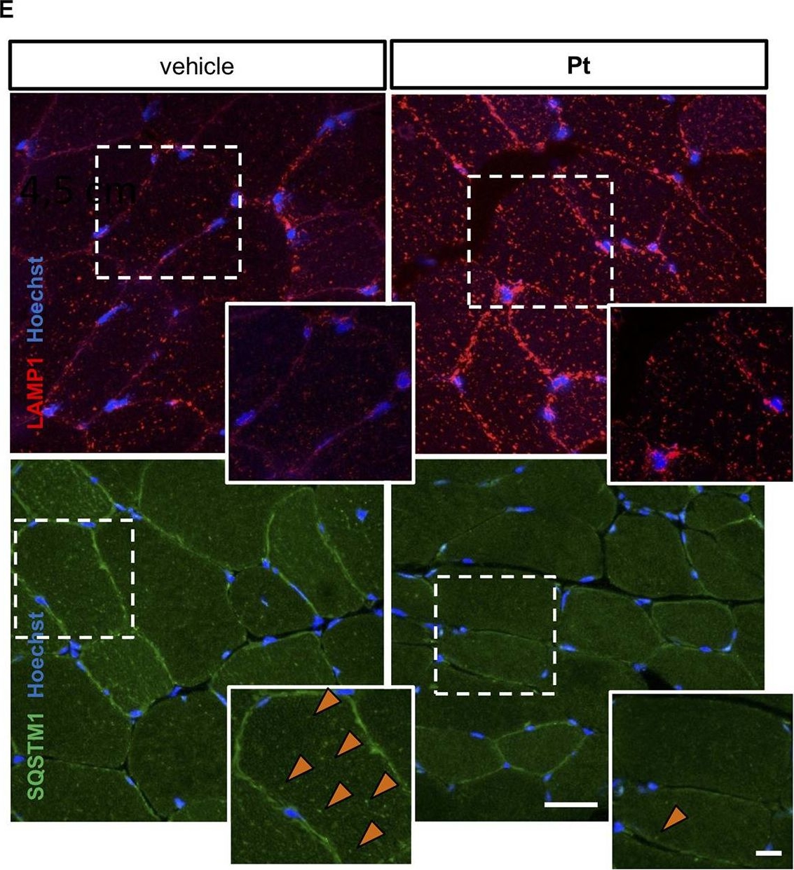 The Polyphenol Pterostilbene Ameliorates the Myopathic Phenotype of Collagen VI Deficient Mice via Autophagy Induction.