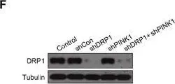 Fig.5.F showing Western Blotting in a Homo sapiens (Human) sample from the publication: Polyphyllin I induces mitophagic and apoptotic cell death in human breast cancer cells by increasing mitochondrial PINK1 levels.