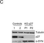 Fig.1.C showing Western Blotting from the publication: p27Kip1 regulates alpha-synuclein expression.