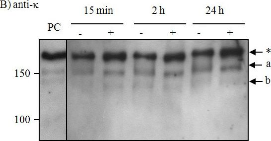 Fig.3.B showing Western Blotting in a Nicotiana tabacum (Common tobacco) sample from the publication: Antibody degradation in tobacco plants: a predominantly apoplastic process.