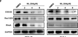 Fig.4.F showing Western Blotting from the publication: Pharmacological manipulation of TRPC5 by kaempferol attenuates metastasis of gastrointestinal cancer via inhibiting calcium involved in the formation of filopodia.