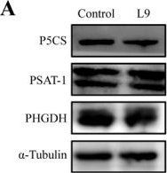 Fig.5.A showing Western Blotting from the publication: Lactobacillus paracasei L9 Ameliorates Pulmonary Fibrosis in Aged Mice via Gut-Lung Axis-Mediated Regulation of Immune Cell Migration.