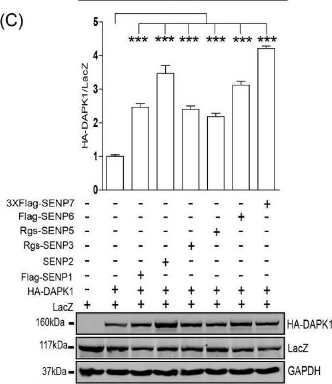 Fig.2.C showing Western Blotting from the publication: Regulation of the Expression of DAPK1 by SUMO Pathway.