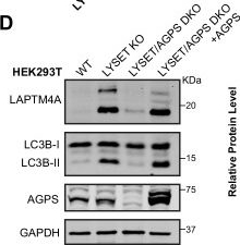 Fig.6.D showing Western Blotting in a Homo sapiens (Human) sample from the publication: Peroxisome-derived ether lipids regulate lysosomal exocytosis.