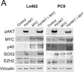 DeltaN p63 (E6Q3O) Rabbit Monoclonal Antibody | Cell Signaling
