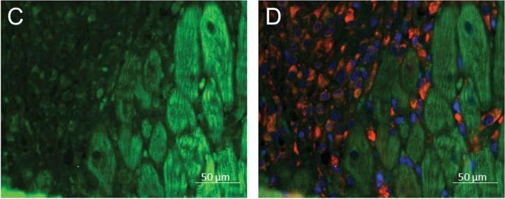 Fig.2.C,D showing Immunohistochemistry-immunofluorescence in a Rattus norvegicus (Rat) sample from the publication: (Pro)renin receptor triggers distinct angiotensin II-independent extracellular matrix remodeling and deterioration of cardiac function.