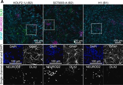 Fig.5.A showing Immunohistochemistry-immunofluorescence from the publication: Electrophysiological development and functional plasticity in dissociated human cerebral organoids across multiple cell lines.