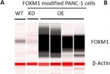 Fig.7.A showing Simple Western - Size in a Homo sapiens (Human) sample from the publication: The Preclinical Effects and Mechanisms of Biofield Therapy on Pancreatic Cancer Cell Growth and Metastasis.