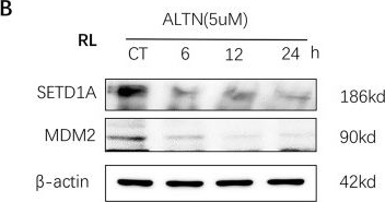 Fig.5.B showing Western Blotting in a Homo sapiens (Human) sample from the publication: Anlotinib suppresses the DNA damage response by disrupting SETD1A and inducing p53-dependent apoptosis in Transformed Follicular Lymphoma.