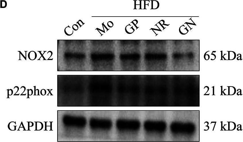 Fig.3.D showing Western Blotting in a Mus musculus (House mouse) sample from the publication: Geniposide Combined With Notoginsenoside R1 Attenuates Inflammation and Apoptosis in Atherosclerosis via the AMPK/mTOR/Nrf2 Signaling Pathway.