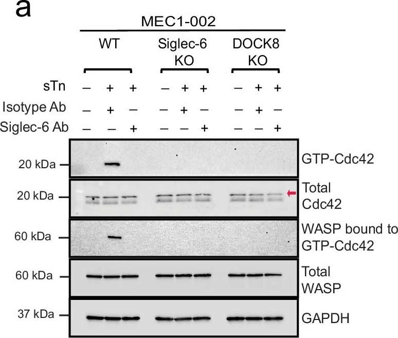 Fig.6.A showing Western Blotting from the publication: Siglec-6 as a therapeutic target for cell migration and adhesion in chronic lymphocytic leukemia.