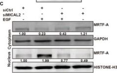 MKL1/MRTF-A Antibody | Cell Signaling Technology