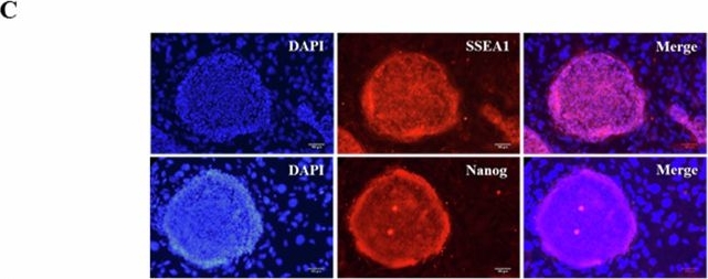 Fig.1.C showing Immunocytochemistry-immunofluorescence in a Mus musculus (House mouse) sample from the publication: Neural stem cells derived from α-synuclein-knockdown iPS cells alleviate Parkinson's disease.