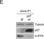 Fig.1.E showing Western Blotting from the publication: p27Kip1 regulates alpha-synuclein expression.