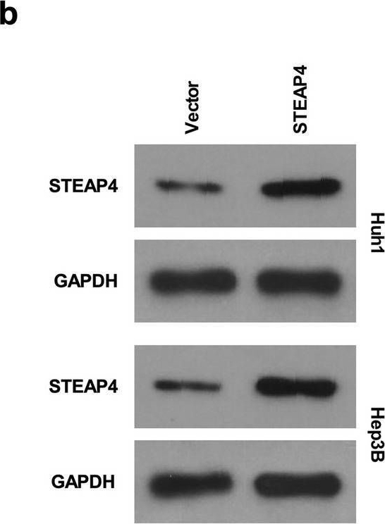 Fig.2.B showing Western Blotting from the publication: STEAP4 inhibits cisplatin-induced chemotherapy resistance through suppressing PI3K/AKT in hepatocellular carcinoma.