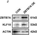Fig.8.J showing Western Blotting from the publication: Downregulation of KLF10 contributes to the regeneration of survived renal tubular cells in cisplatin-induced acute kidney injury via ZBTB7A-KLF10-PTEN axis.