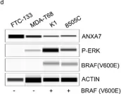 Fig.2.D showing Simple Western - Size in a Homo sapiens (Human) sample from the publication: Role of Annexin 7 (ANXA7) as a Tumor Suppressor and a Regulator of Drug Resistance in Thyroid Cancer.