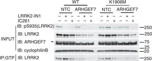 Fig.5.C showing Western Blotting in a Homo sapiens (Human) sample from the publication: Phosphorylation of LRRK2 by casein kinase 1α regulates trans-Golgi clustering via differential interaction with ARHGEF7.