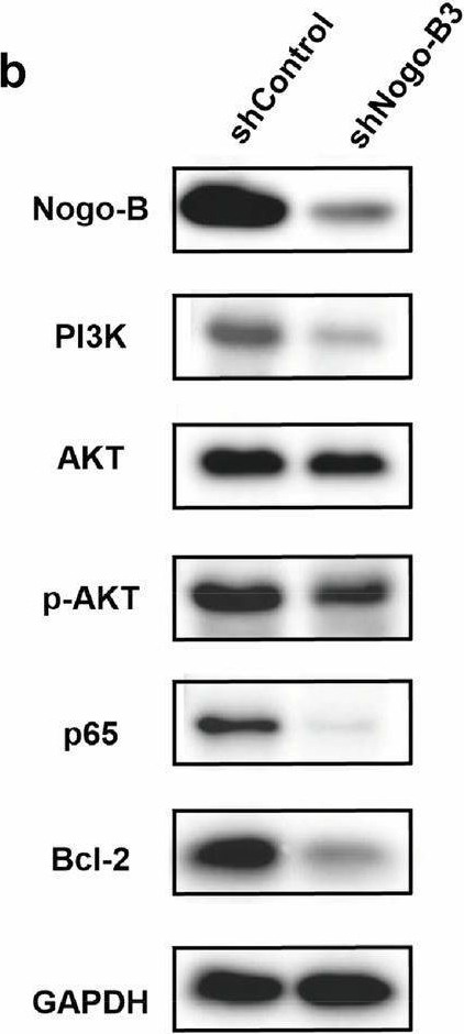 Fig.6.B showing Western Blotting in a Homo sapiens (Human) sample from the publication: Identification of Nogo-B as a potential therapeutic target of osteosarcoma via stereochemically selective covalent probes.