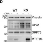 Fig.3.D showing Western Blotting from the publication: AMPK-dependent phosphorylation of MTFR1L regulates mitochondrial morphology.
