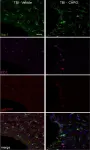 Fig.5.A showing Immunohistochemistry-immunofluorescence in a Mus musculus (House mouse) sample from the publication: Delayed mGluR5 activation limits neuroinflammation and neurodegeneration after traumatic brain injury.