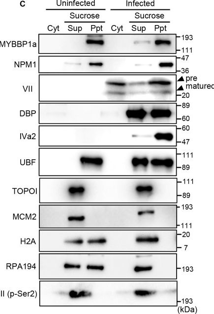 Fig.1.C showing Western Blotting from the publication: Nuclear reorganization by NPM1-mediated phase separation triggered by adenovirus core protein VII.