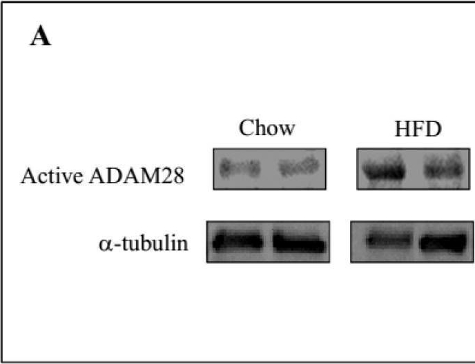 Fig.3.A showing Western Blotting in a Mus musculus (House mouse) sample from the publication: The Metalloproteinase ADAM28 Promotes Metabolic Dysfunction in Mice.