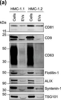 Fig.1.A showing Western Blotting in a Homo sapiens (Human) sample from the publication: Selective immunocapture reveals neoplastic human mast cells secrete distinct microvesicle- and exosome-like populations of KIT-containing extracellular vesicles.