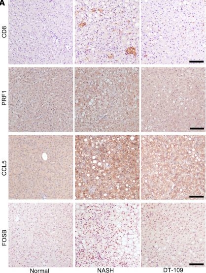 Fig.2.A showing Immunohistochemistry from the publication: Metabolic dysfunction-associated steatohepatitis exacerbated by Clostridium perfringens-derived ammonia is attenuated by tripeptide DT-109.