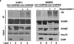 Fig.2.F showing Western Blotting in a Homo sapiens (Human) sample from the publication: CHIP/STUB1 Ubiquitin Ligase Functions as a Negative Regulator of ErbB2 by Promoting Its Early Post-Biosynthesis Degradation.