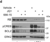 Fig.6.D showing Western Blotting from the publication: Retinoblastoma protein as an intrinsic BRD4 inhibitor modulates small molecule BET inhibitor sensitivity in cancer.