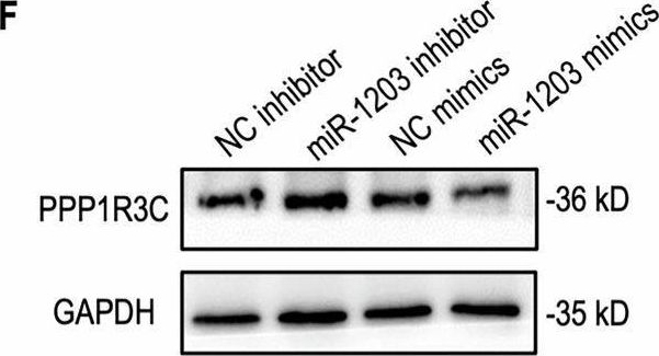 Fig.5.F showing Western Blotting in a Homo sapiens (Human) sample from the publication: QKI-induced circ_0001766 inhibits colorectal cancer progression and rapamycin resistance by miR-1203/PPP1R3C/mTOR/Myc axis.