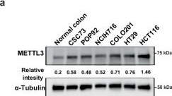 Fig.3.A showing Western Blotting from the publication: m6A modification suppresses innate anti-tumour immunity in colorectal cancer by limiting alu-derived dsRNA accumulation.