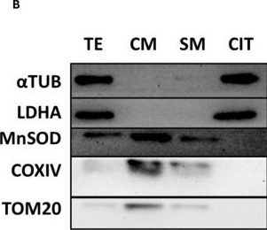 Fig.1.B showing Western Blotting from the publication: Mitochondrial Dysfunction Combined with Elevated CoQ10 Levels Specifically in Placental Cytotrophoblasts Suggests a Role for Mitophagy in Preeclampsia.