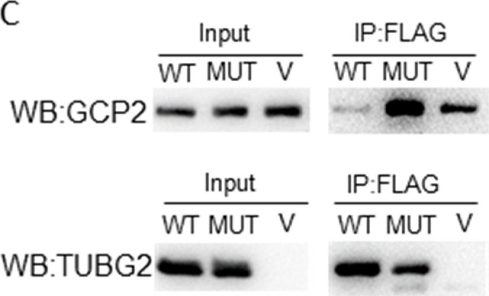 Fig.4.C showing Western Blotting in a Homo sapiens (Human) sample from the publication: A De Novo Missense Variant in TUBG2 in a Child with Global Developmental Delay, Microcephaly, Refractory Epilepsy and Perisylvian Polymicrogyria.