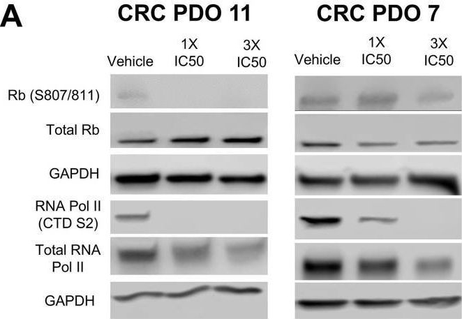 Fig.4.A showing Western Blotting in a Homo sapiens (Human) sample from the publication: Dual targeting of conserved cell cycle and transcription programs in advanced colorectal cancer by fadraciclib.