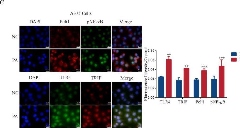 Fig.3.C showing Immunocytochemistry-immunofluorescence from the publication: Palmitic Acid Promotes Lung Metastasis of Melanomas via the TLR4/TRIF-Peli1-pNF-κB Pathway.