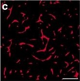 Fig.9.C showing Neutralization experiments in a Homo sapiens (Human) sample from the publication: Hypoxia-induced responses by endothelial colony-forming cells are modulated by placental growth factor.