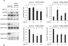 Fig.2.A showing Western Blotting from the publication: Transforming Growth Factor-β1 Induced Epithelial Mesenchymal Transition is blocked by a chemical antagonist of translation factor eIF4E.