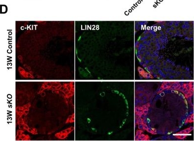 Fig.2.D showing Immunohistochemistry-immunofluorescence from the publication: METTL16 and YTHDC1 Regulate Spermatogonial Differentiation via m6A.