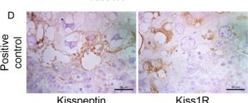 Fig.6.D showing Immunohistochemistry in a Rattus norvegicus (Rat) sample from the publication: Hypothyroidism Alters Uterine Kisspeptin System and Activity Modulators in Cyclic Rats.