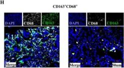 CD163 (D6U1J) Rabbit Monoclonal Antibody | Cell Signaling Technology