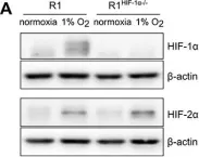 Fig.2.A showing Western Blotting in a Mus musculus (House mouse) sample from the publication: Hypoxia favors myosin heavy chain beta gene expression in an Hif-1alpha-dependent manner.