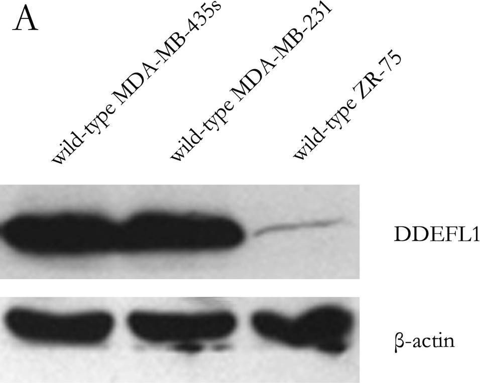 Fig.3.A showing Western Blotting in a Homo sapiens (Human) sample from the publication: DDEFL1 correlated with Rho GTPases activity in breast cancer.