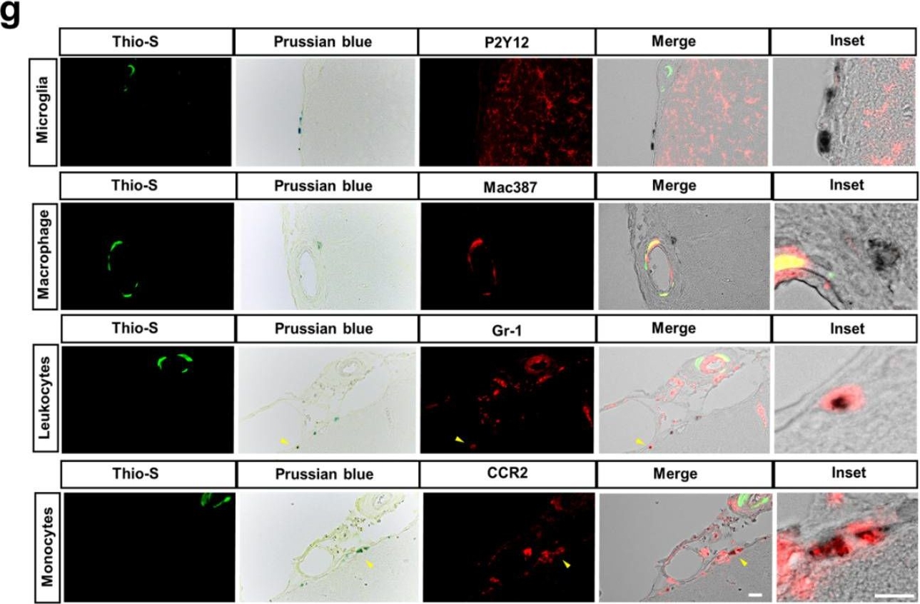 Fig.5.G showing Immunohistochemistry-immunofluorescence in a Mus musculus (House mouse) sample from the publication: Amyloid-β (Aβ) immunotherapy induced microhemorrhages are associated with activated perivascular macrophages and peripheral monocyte recruitment in Alzheimer's disease mice.