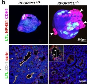 Fig.6.B showing Immunohistochemistry-immunofluorescence from the publication: Drug and siRNA screens identify ROCK2 as a therapeutic target for ciliopathies.