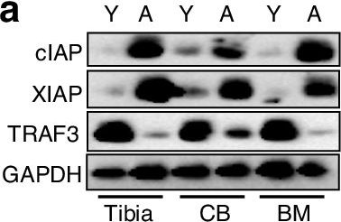 Fig.4.A showing Western Blotting in a Mus musculus (House mouse) sample from the publication: A RANKL+/CXCR4+ B cell population accumulates in bone marrow and causes age-related osteoporosis in mice.