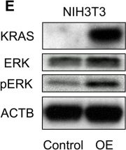 Fig.2.E showing Western Blotting in a Homo sapiens (Human) sample from the publication: Metabolic Adaptation to Nutritional Stress in Human Colorectal Cancer.