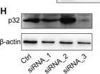 Fig.9.H showing Western Blotting in a Mus musculus (House mouse) sample from the publication: The mitochondrial long non-coding RNA lncMtloop regulates mitochondrial transcription and suppresses Alzheimer's disease.